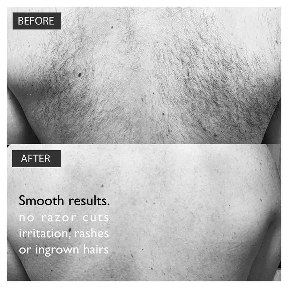 Load image into Gallery viewer, Back Hair Removal back shaver