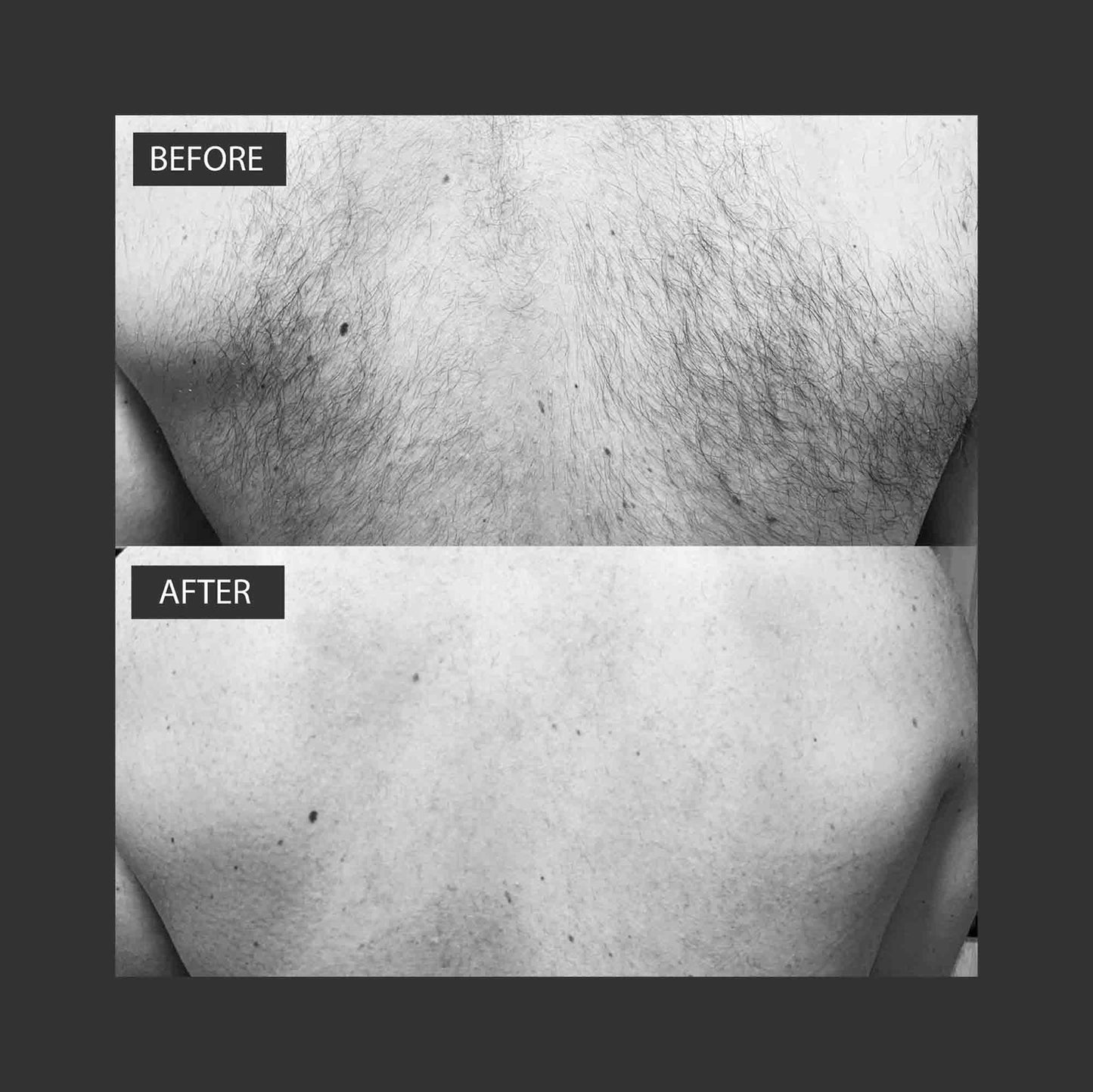 Back Hair Removal cream kit back shaver