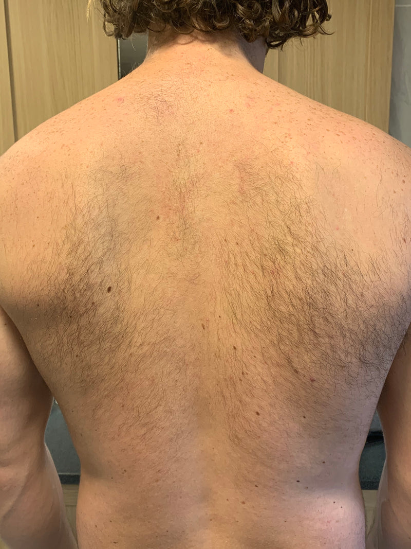 Before image