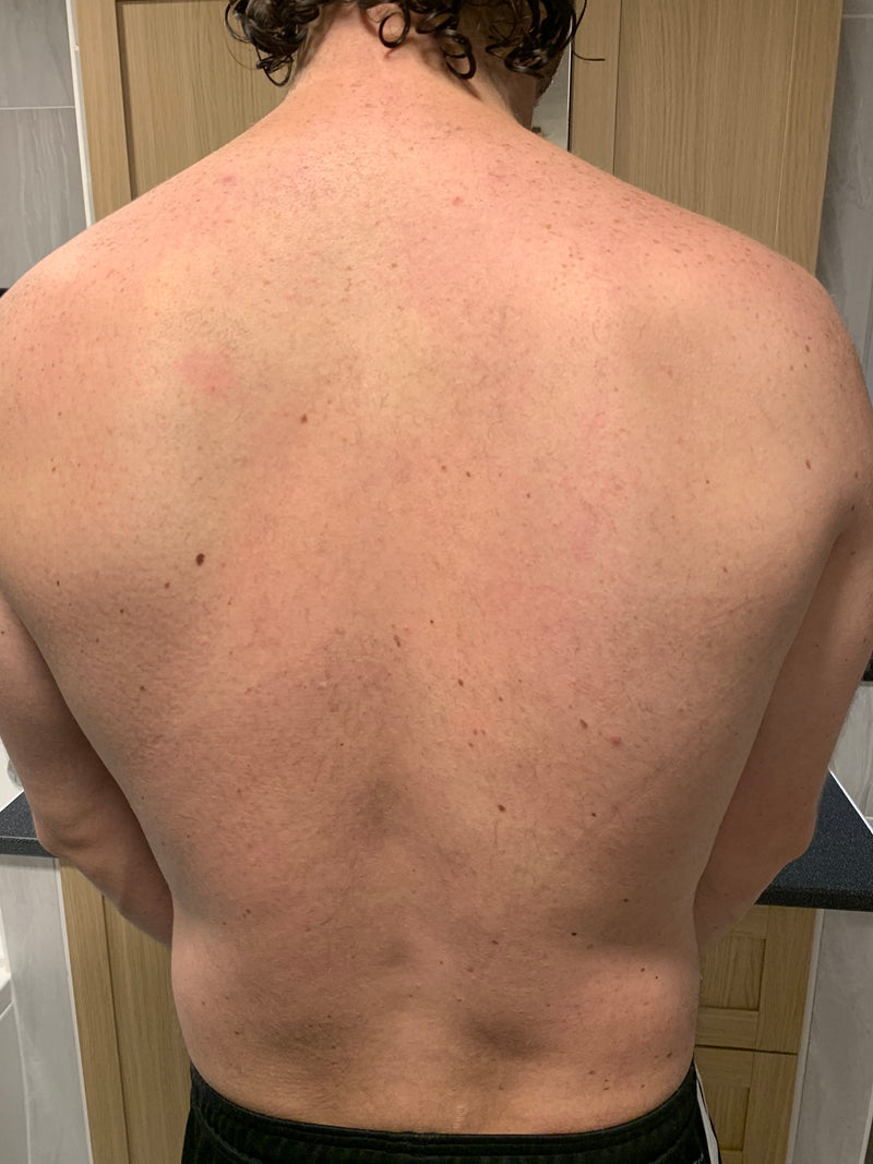 After image