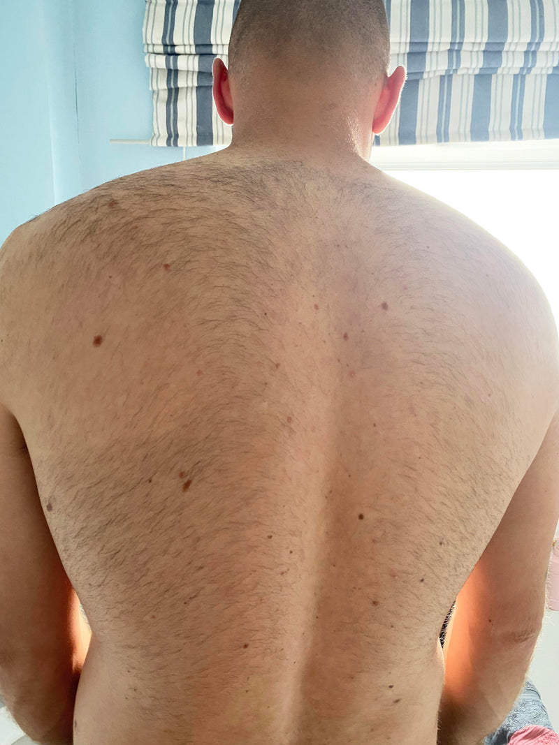 Before image