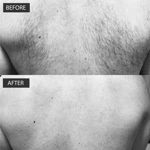 
                  
                    Load image into Gallery viewer, Back &amp;amp; Body Hair Removal - The Silverback Kit
                  
                